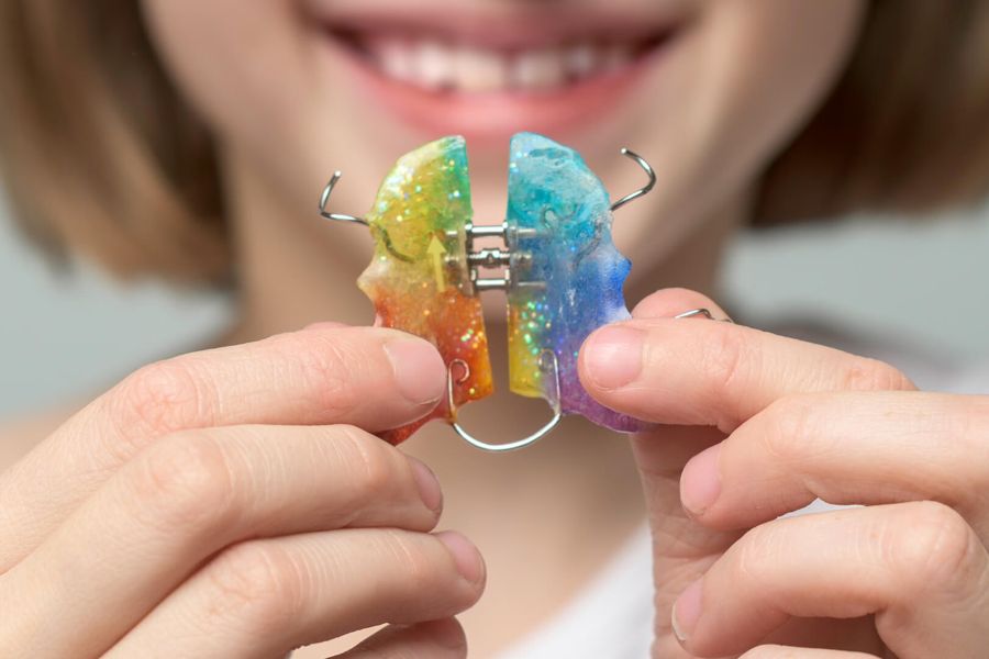 Duas mãos segurando um aparelho expansor removível de acrílico colorido, com fios metálicos, diante do sorriso desfocado de uma criança