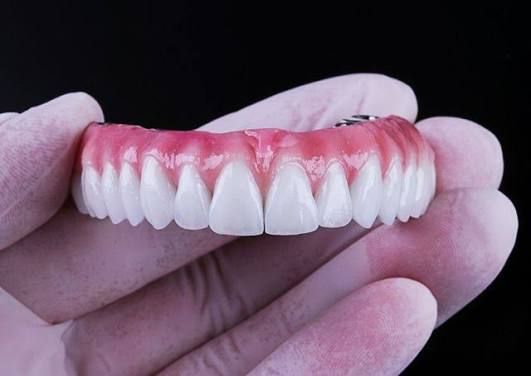 Prótese fixa sobre implantes, com dentes e gengiva artificial, segurada entre as mãos