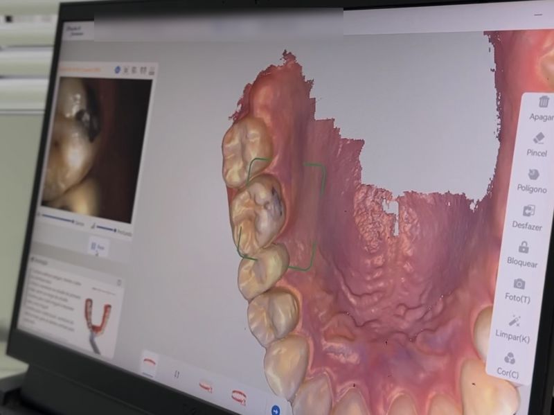 Tela do computador com o registro digital em três dimensões das superfícies dos dentes